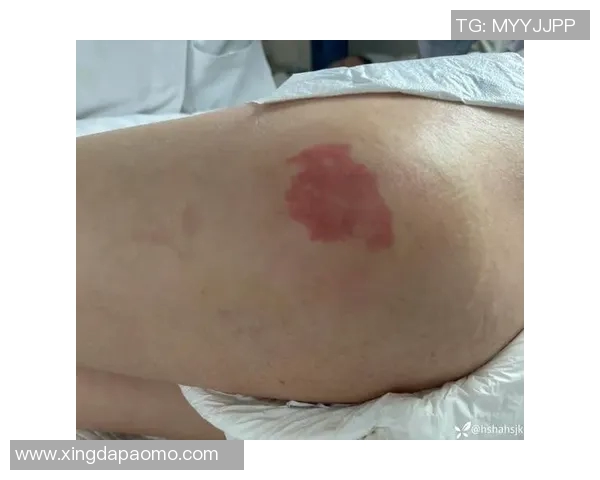 卡斯尔髋部受伤，下周复查进展